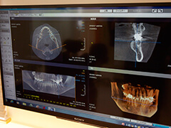 当院では歯科用CT　OP300マキシマを導入しています