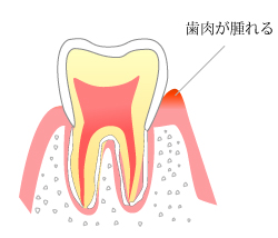 第一段階