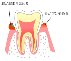 第二段階