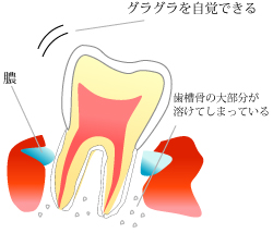 第三段階